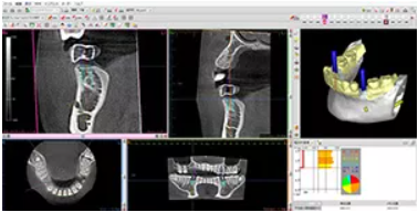 シミュレーションソフト