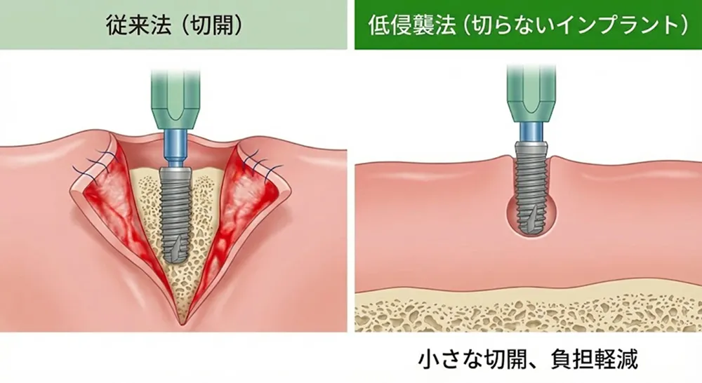 切らないインプラント治療