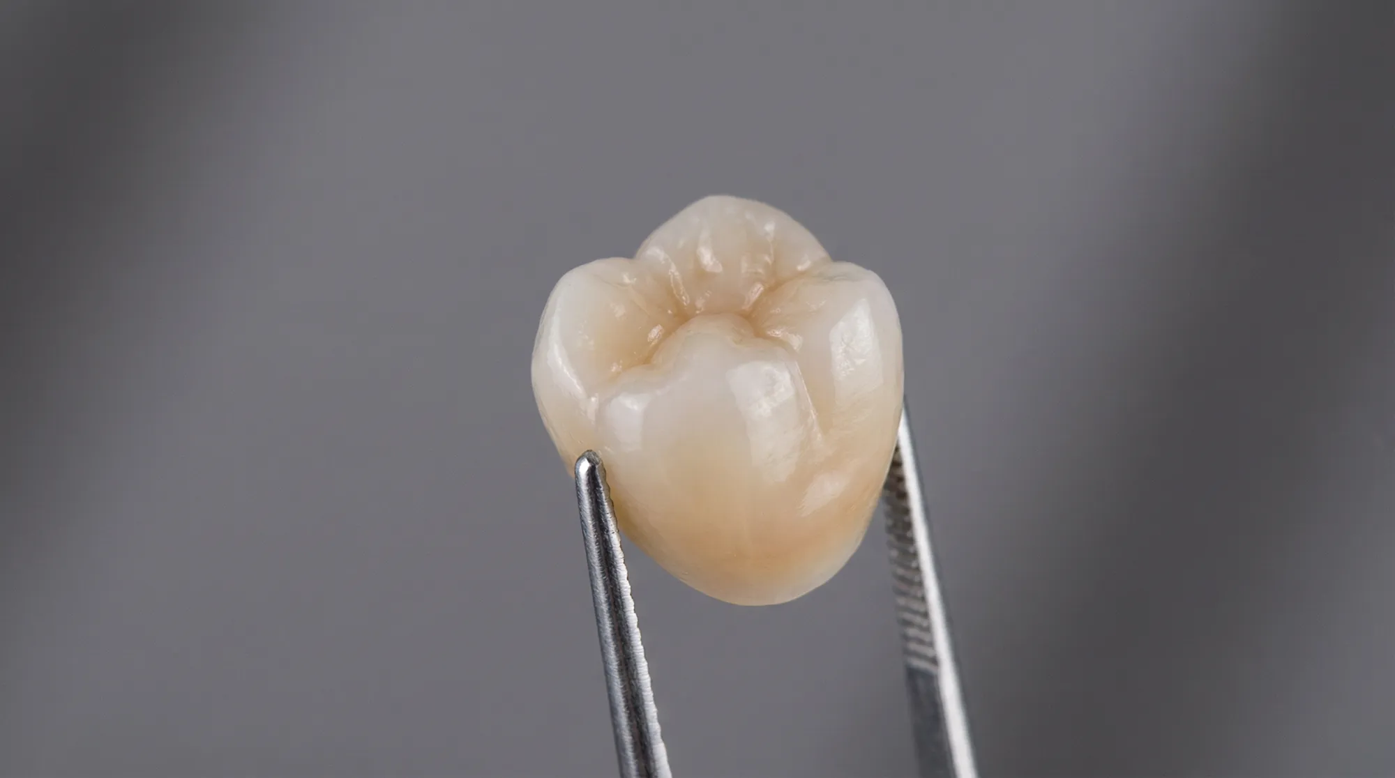 オールセラミック（E-MAX）